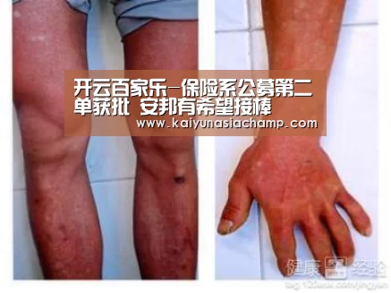 开云百家乐-保险系公募第二单获批 安邦有希望接棒(图2) 开云百家乐